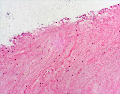 Image representing research in communicable disease and infection control